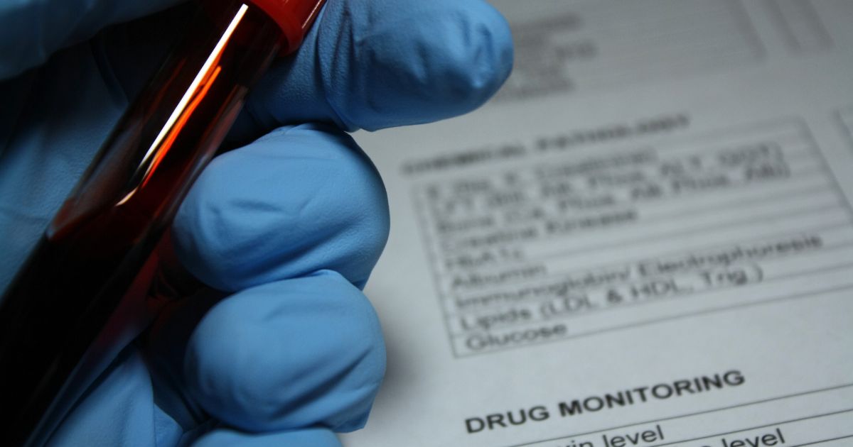 Do Poppers Show Up in a Drug Test? - Poppers Aromas Blog